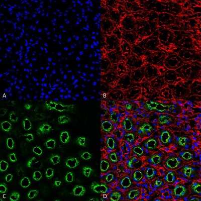 Immunohistochemistry: NKCC2/SLC12A1 Antibody [NBP1-44269]
